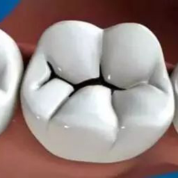 全民爱牙公益行动：牙周病宋利辉口腔怎么应对